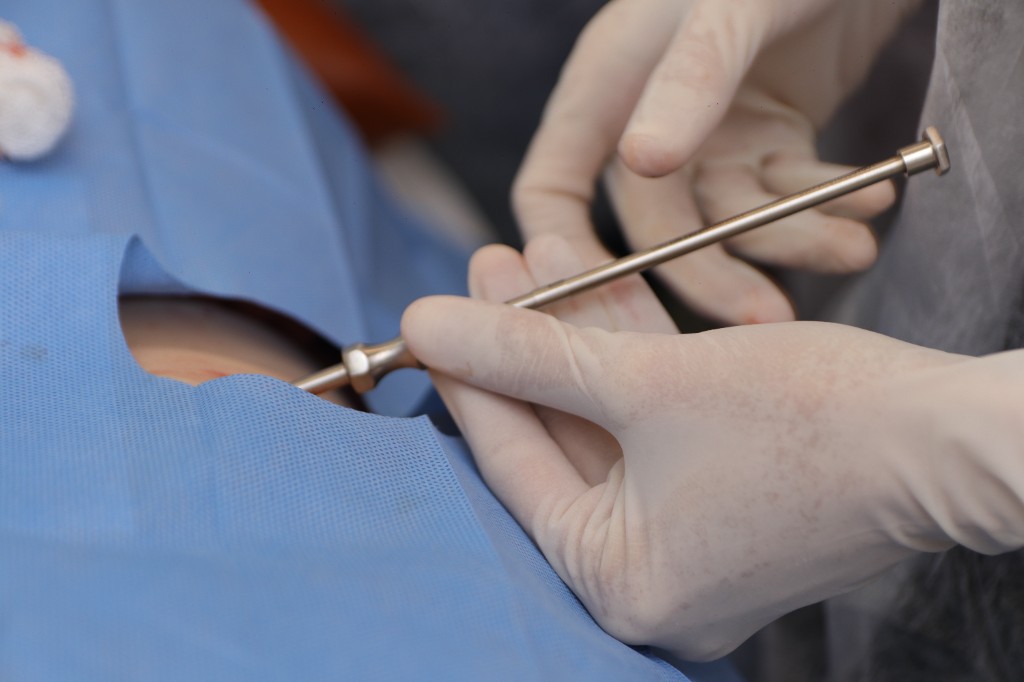 Sesión práctica de capacitación en terapia hormonal